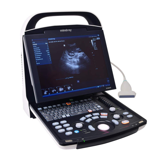 Mindray DP 30 Ultraschallgerät tragbar - mit PW-Doppler für erweiterte Diagnostik - Med-Praxisbedarf