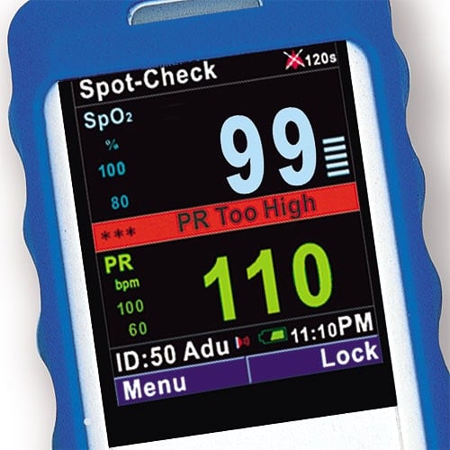 MINDRAY PM 60 Handheld Pulsoximeter Hülle - in verschiedenen Farben erhältlich - Med-Praxisbedarf
