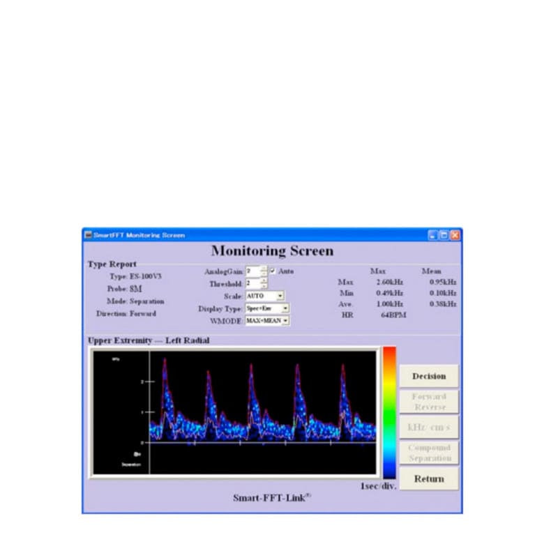 Smart-V-Link Software Oberfläche - zur Auswertung von Smartdop 45 und ES-100V3 Dopplerdaten - Med-Praxisbedarf