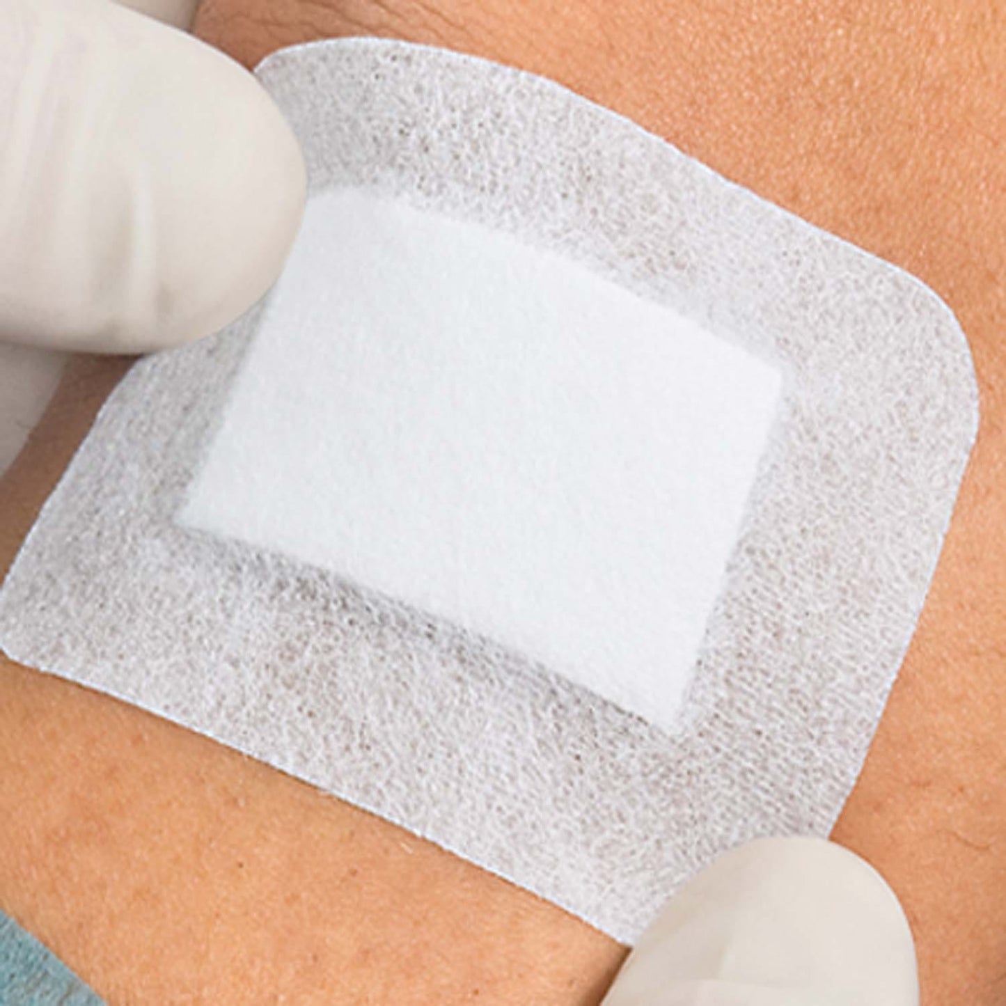 Cosmopor Advance Wundverband mittel - wechseln ohne Schmerzen, hautschonend - Med-Praxisbedarf