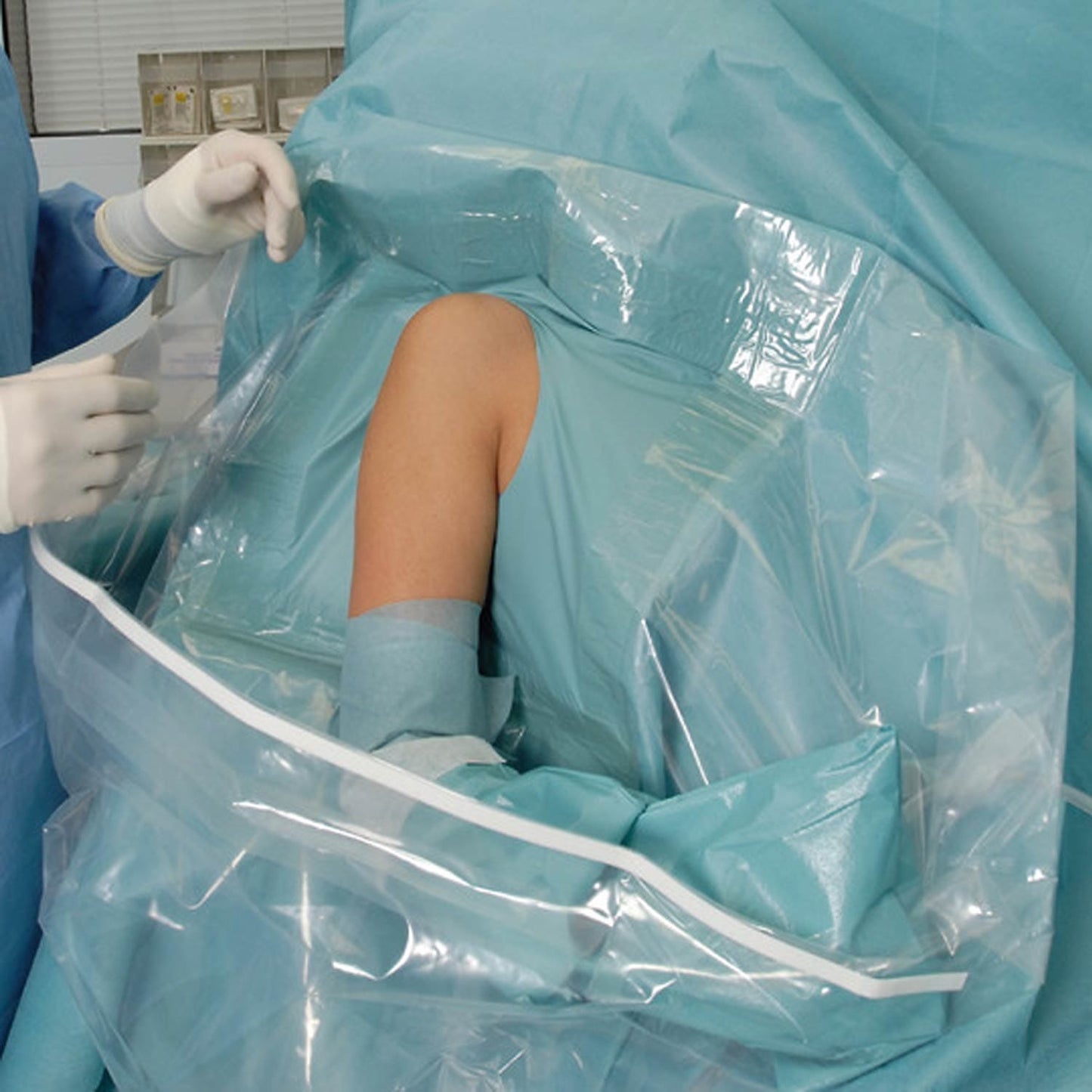 Arthroskopie-Set von Foliodrape Protect Plus - sterile OP-Abdeckung für Gelenkoperationen - Med-Praxisbedarf