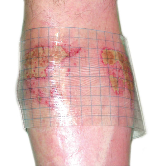 HydroTac transparent Gelverband ohne Rand - hydroaktiv für trockene Wunden - Med-Praxisbedarf