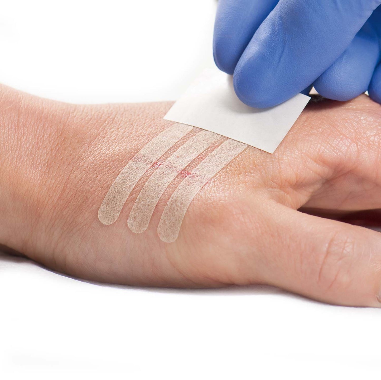 Omnistrip sterile Wundverschlussstreifen - hautfreundlicher Vliesstoff für Nahtentlastung - Med-Praxisbedarf