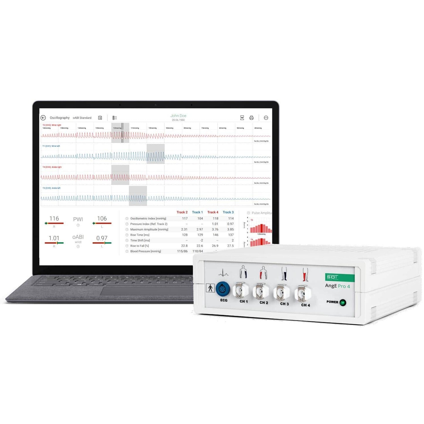 ABI+ Gerät von SOT Medical - technische Detailansicht des AngE™ für Gefäßdiagnostik - Med-Praxisbedarf