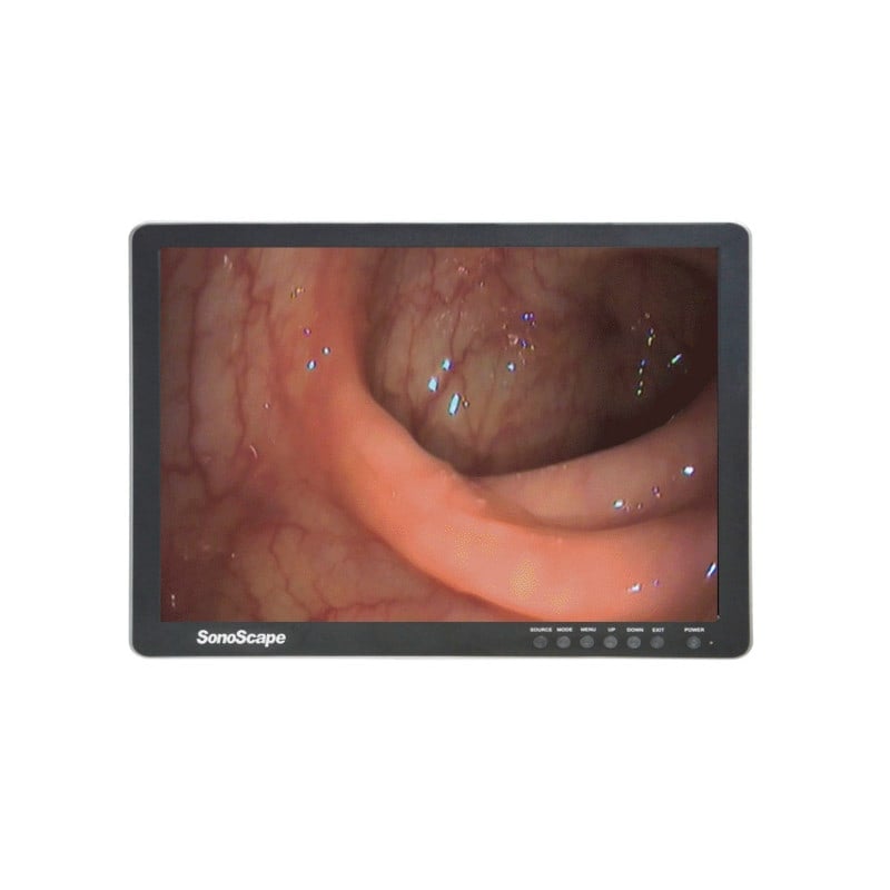24 Zoll LCD Farb-Monitor von SonoScape - Weitwinkelansicht für medizinische Darstellung - Med-Praxisbedarf