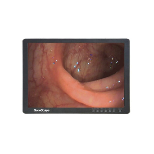 24 Zoll LCD Farb-Monitor von SonoScape - Weitwinkelansicht für medizinische Darstellung - Med-Praxisbedarf
