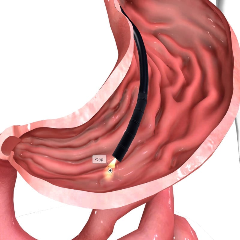 Detailansicht HD-500 Video-Gastroskop - mit Steuerungseinheit für Endoskopie - Med-Praxisbedarf