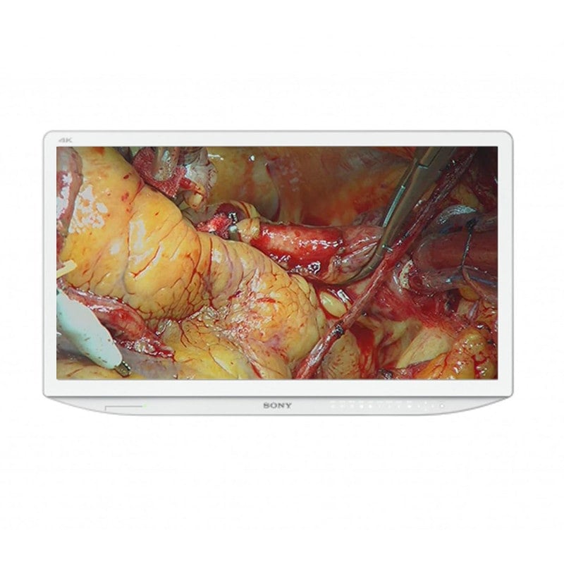SONY LMD-X310MD 4K Monitor - 31-Zoll-Display für medizinische 2D-Farbvideobilder - Med-Praxisbedarf