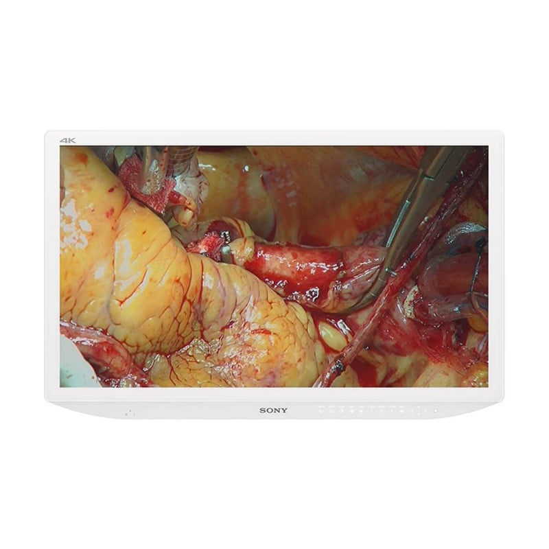 SONY LMD-X3200MD 4K Monitor - 32 Zoll medizinisches LCD-Display für Kliniken - Med-Praxisbedarf