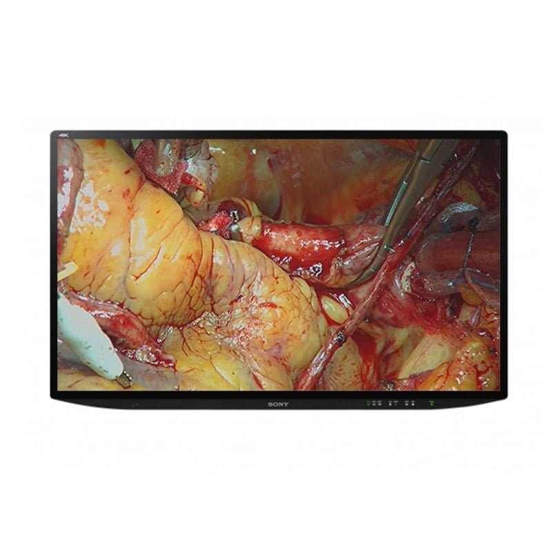 SONY 3D Farbvideomonitor - zeigt hochwertige Darstellung für laparoskopische Eingriffe - Med-Praxisbedarf