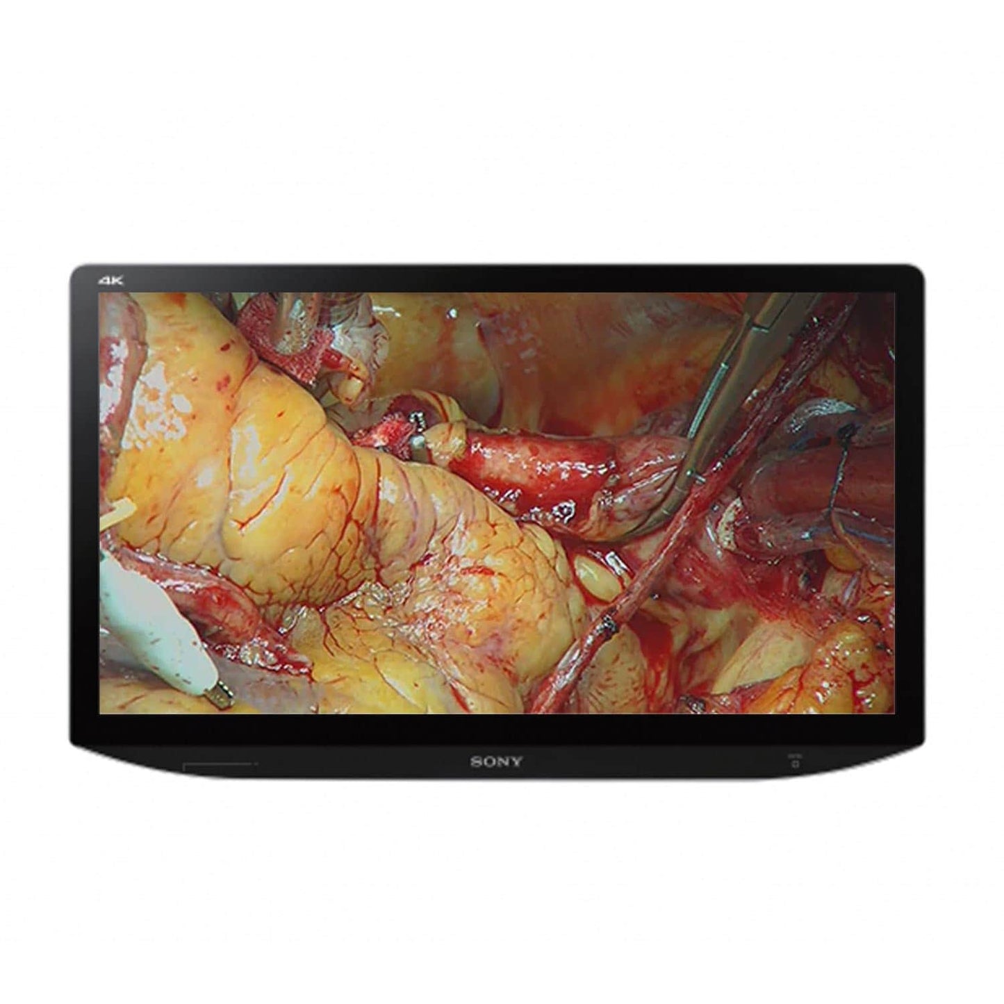 SONY Monitor für medizinische Bildgebung - 4K Ultra HD Display für endoskopische Systeme - Med-Praxisbedarf