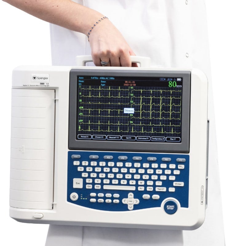 Cardiomate EKG-Gerät im Einsatz - EKG-Kabelanschlüsse und Papierauswurf - Med-Praxisbedarf