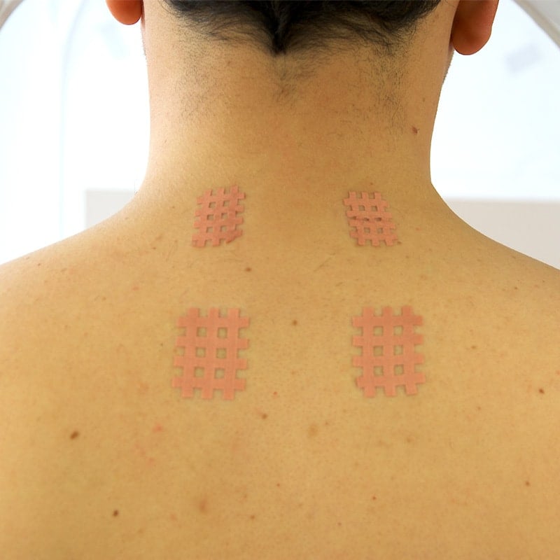 Gitterpflaster zur Muskelstimulation - Selbstklebendes Tape für therapeutische Anwendungen - Med-Praxisbedarf