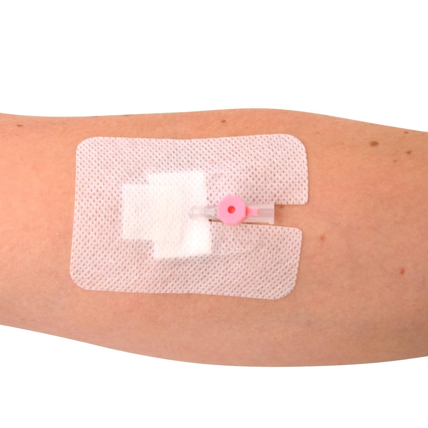 Fixierpflaster für Kanülen Teqler - zur sicheren Wundversorgung im klinischen Alltag - Med-Praxisbedarf
