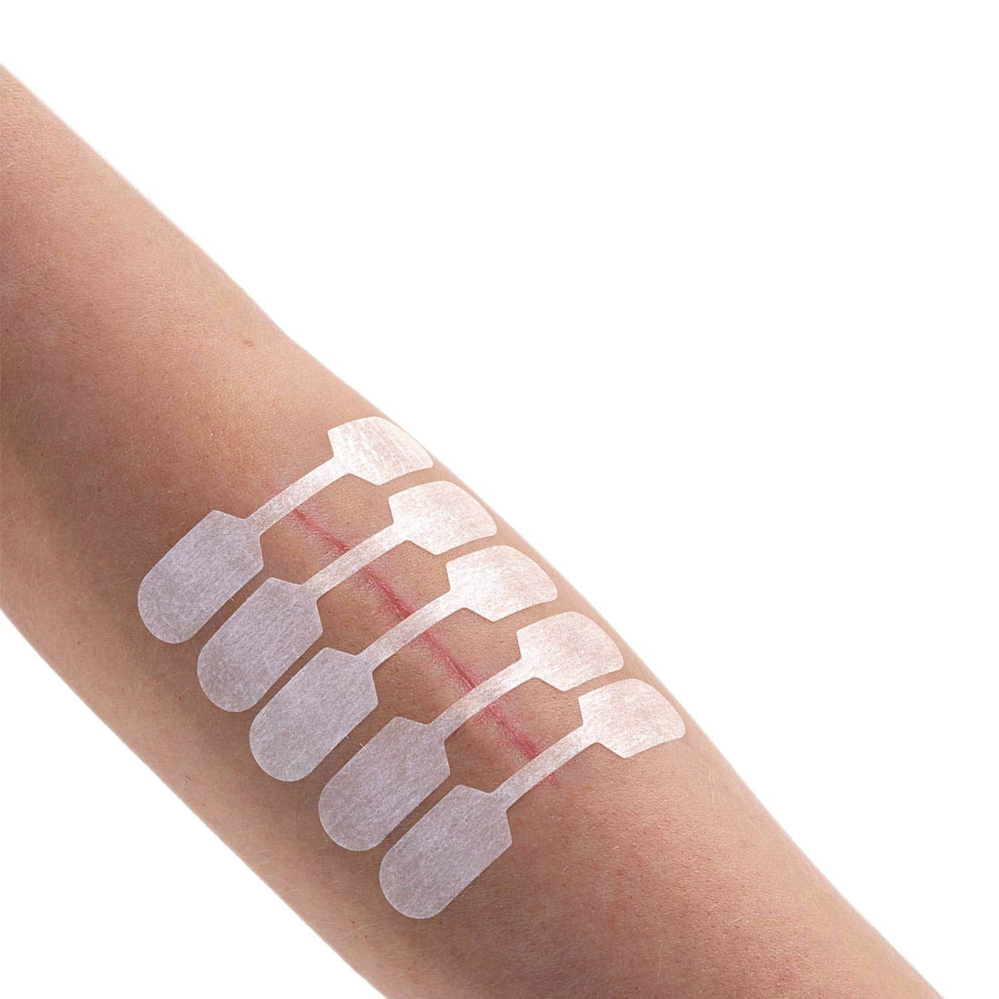 Sterigrap Wundnahtstreifen Verpackung - praktische Rolle für sichere Wundnaht - Med-Praxisbedarf