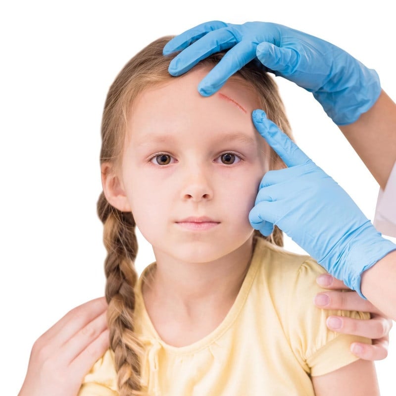 TRUglue Wundkleber - steriler nahtloser Wundverschluss für frische Verletzungen - Med-Praxisbedarf