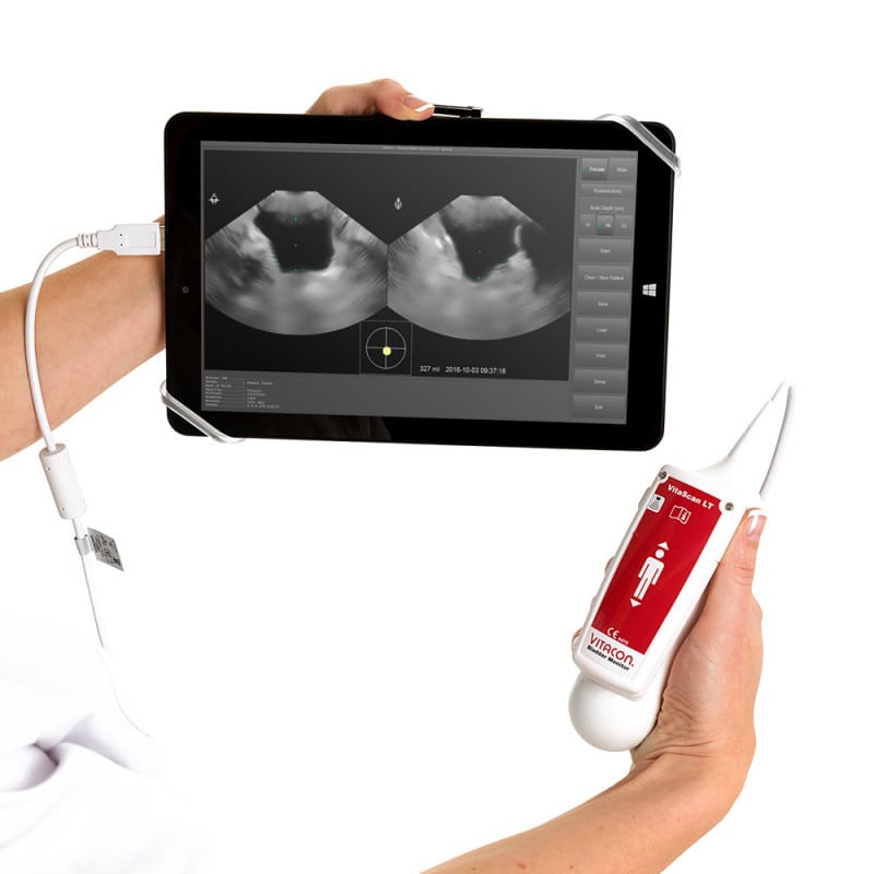 VitaScan v.2 Blasenscanner - 3D-Ultraschallgerät zur nicht-invasiven Harnblasenmessung - Med-Praxisbedarf