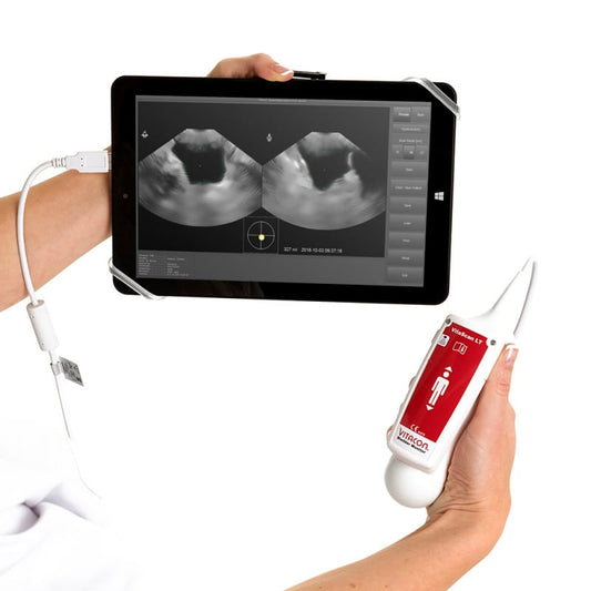 VitaScan v.2 Blasenscanner - 3D-Ultraschallgerät zur nicht-invasiven Harnblasenmessung - Med-Praxisbedarf