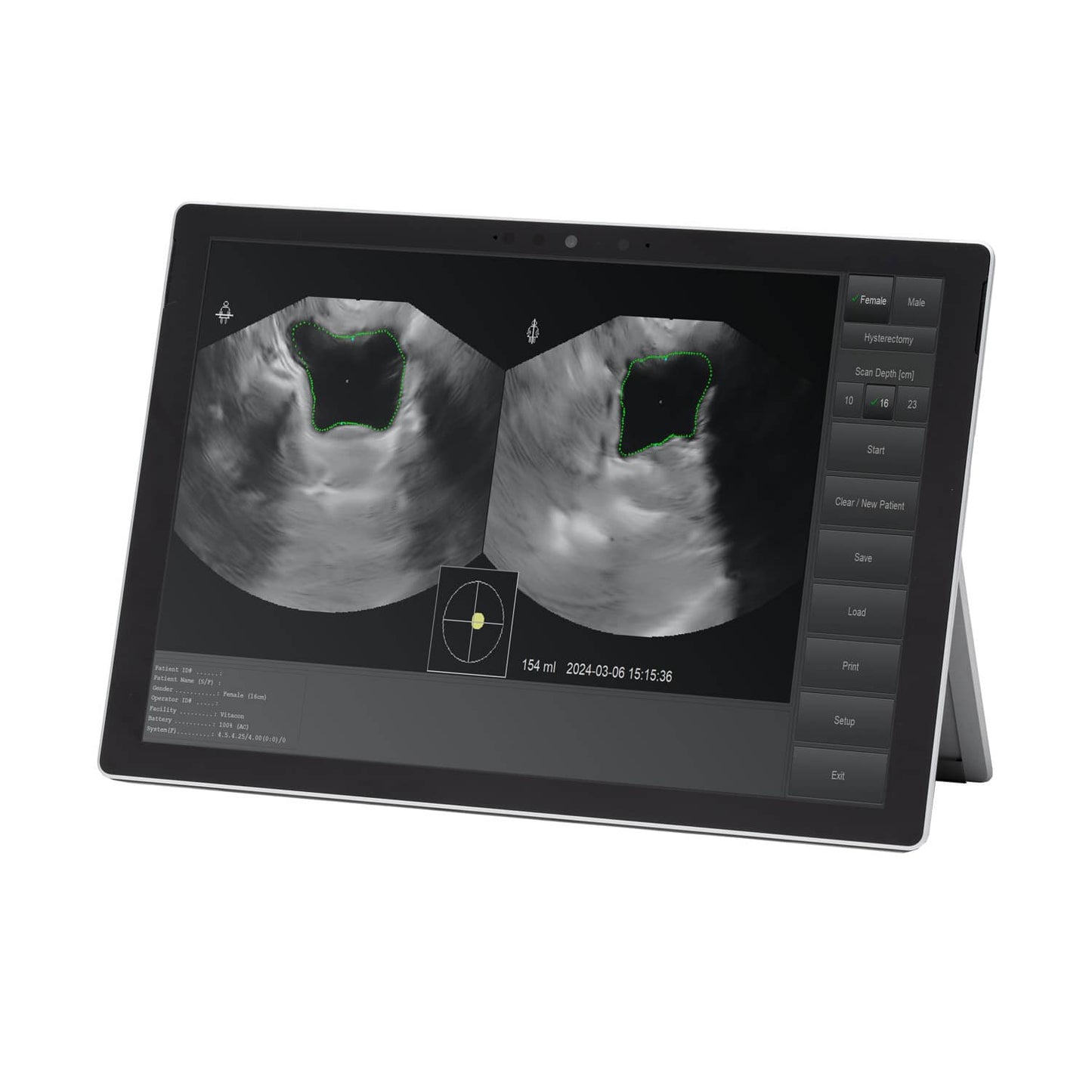 Vitascan LT Blasenscanner - kabelloser Schallkopf am Blasenscanner - Med-Praxisbedarf