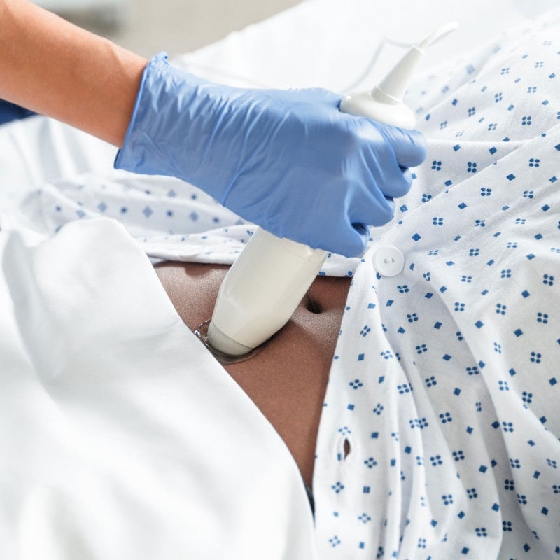 Tragbarer Blasenscanner cVue - kompaktes B-Mode-Gerät für den Einsatz im Krankenhaus - Med-Praxisbedarf
