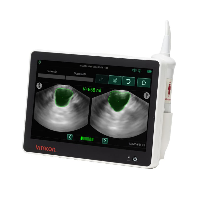 Vitascan eVue Blasenscanner - kompaktes Standalone-Gerät in der Nahaufnahme - Med-Praxisbedarf