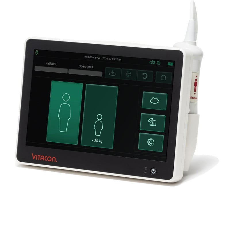 Vitascan eVue Blasenscanner - tragbarer Ultraschallscanner für die mobile Patientenversorgung - Med-Praxisbedarf