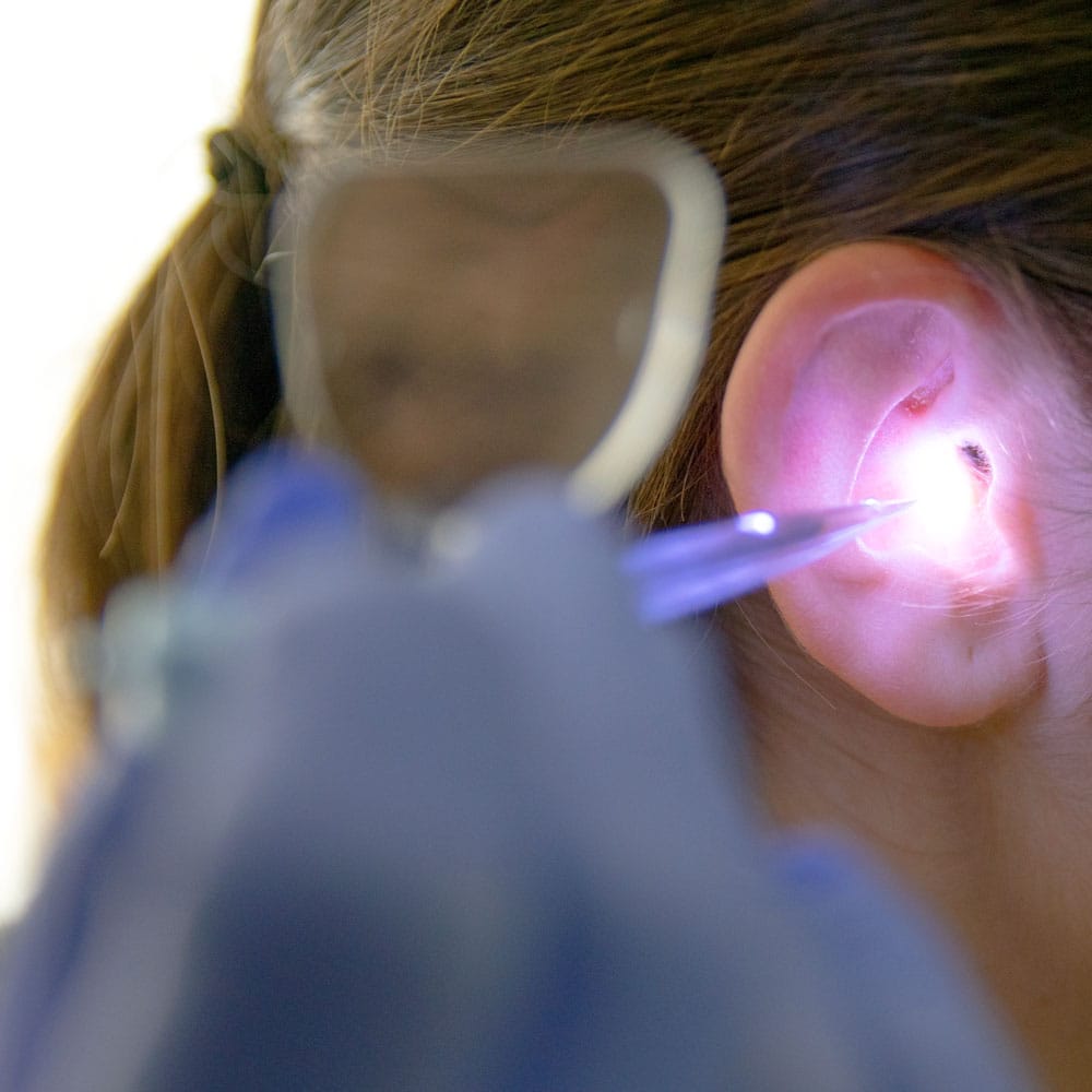 Vergrößerungs-Ohrkürette Bionix - medizinisches Instrument für die Cerumen-Entfernung - Med-Praxisbedarf