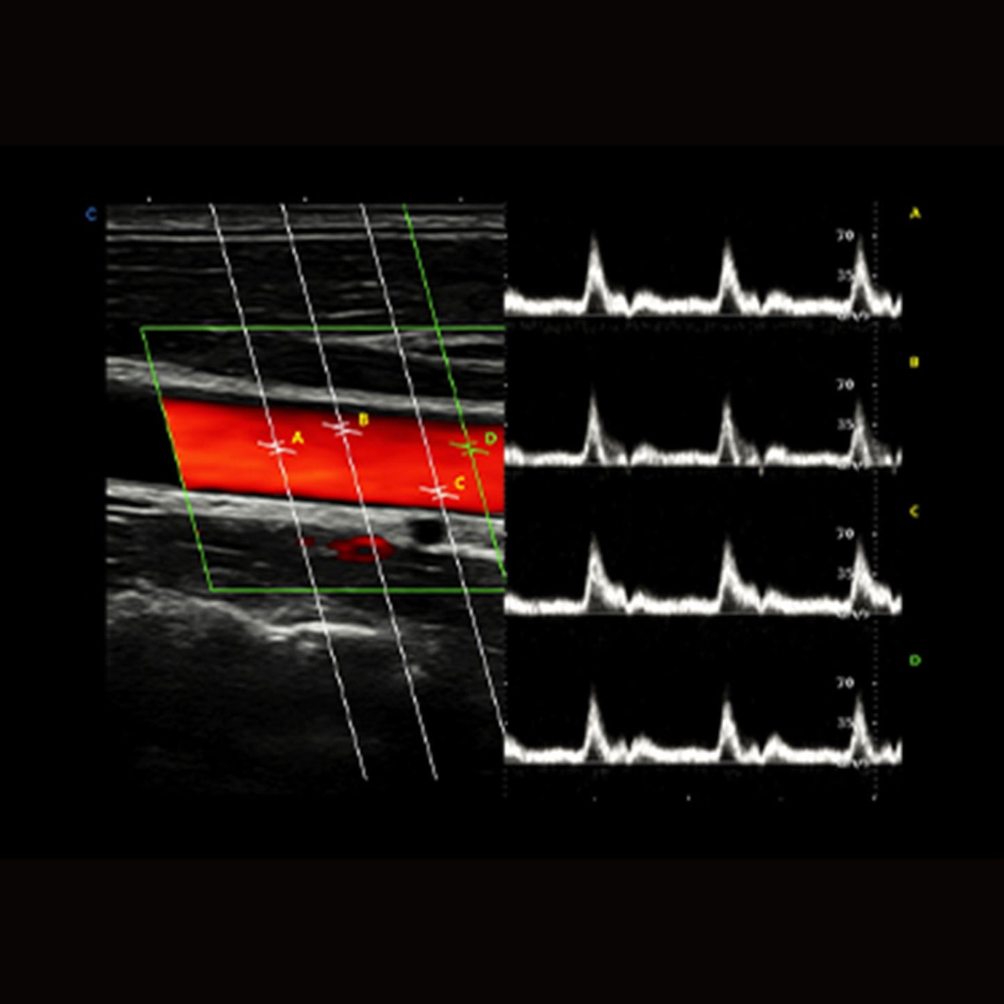 CBit 10 Ultraschallsystem | günstig kaufen