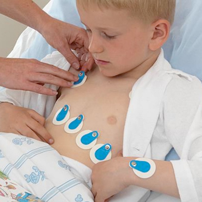 Ambu BlueSensor Ergometrie-Elektroden im klinischen Einsatz - professionelle EKG-Überwachung bei Patienten - Med-Praxisbedarf